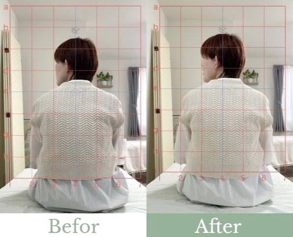 Before After 5